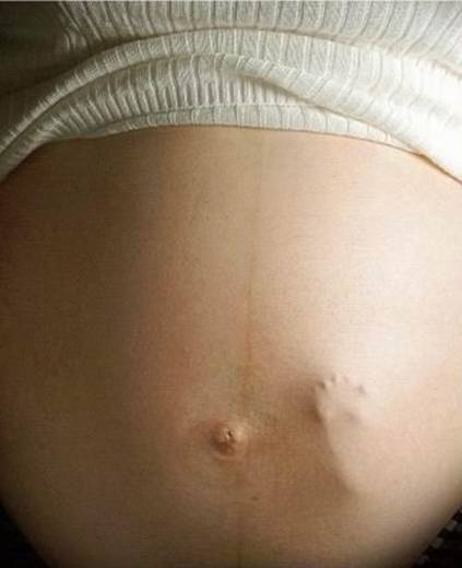 kate hudson pregnant belly. Victoria and David Beckham